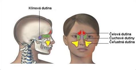 schéma nosovej dutiny a oblastí pre opuchy po operácii