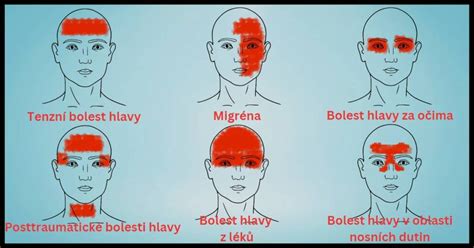Infografika zobrazujúca typické symptómy ochorení z klimatizácie: bolesti hlavy, krku, uší a dýchacie problémy