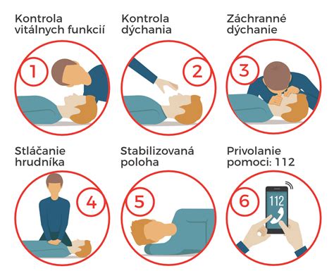 Ilustrácia správneho postupu pri poskytovaní prvej pomoci pri popáleninách.