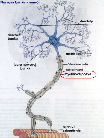 Názorná ilustrácia straty myelínového obalu nervu a vplyv na nervové vlákno.