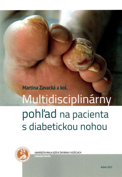 Ilustrácia kúpeľnej starostlivosti o pacienta s diabetickou neuropatiou.