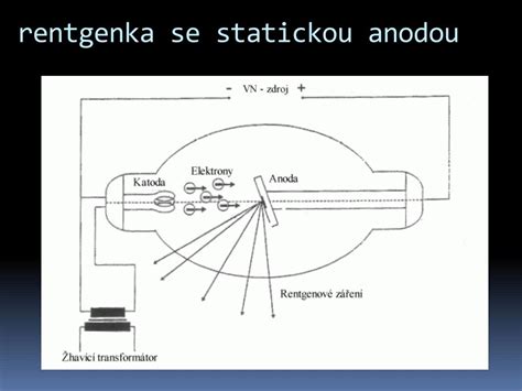 Schéma röntgenovej trubice: katóda (zdroj elektrónov), anóda (terčík) a vznik RTG lúčov