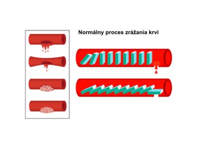 Schéma procesu zrážania krvi (koagulácie)