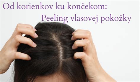 Schéma znázorňujúca vplyv chladiacej čiapky na prekrvenie vlasovej pokožky a ochranu folikulov