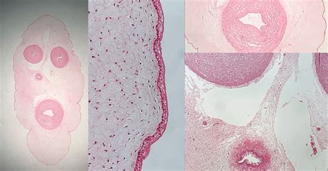 Detailné zobrazenie kvasiniek pod mikroskopom počas fermentácie