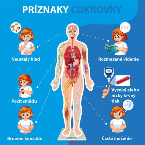 Infografika znázorňujúca stupne podchladenia a ich typické príznaky.