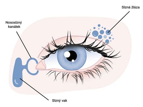 Infografika zobrazujúca symptómy syndrómu suchého oka a preventívne opatrenia vrátane hydratácie.