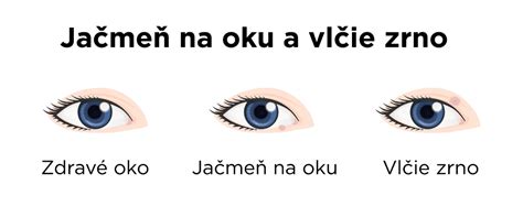 Infografika zobrazujúca estetický rozdiel na fasáde domu pri použití viacerých splitov vs. jedného multisplitu